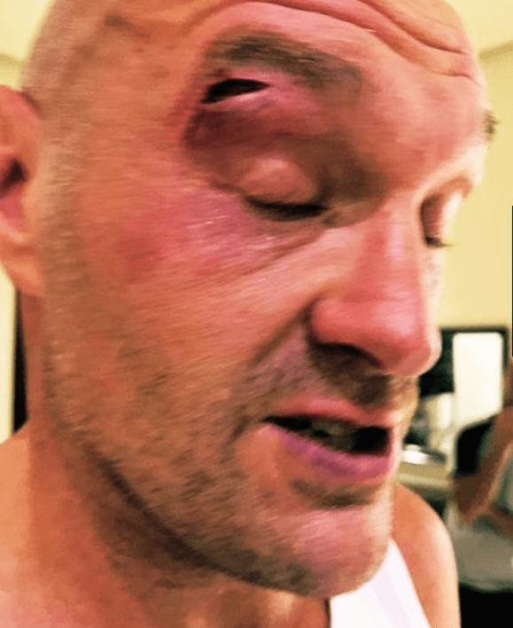 Fury and Usyk gets rescheduled for 18th&nbsp;May